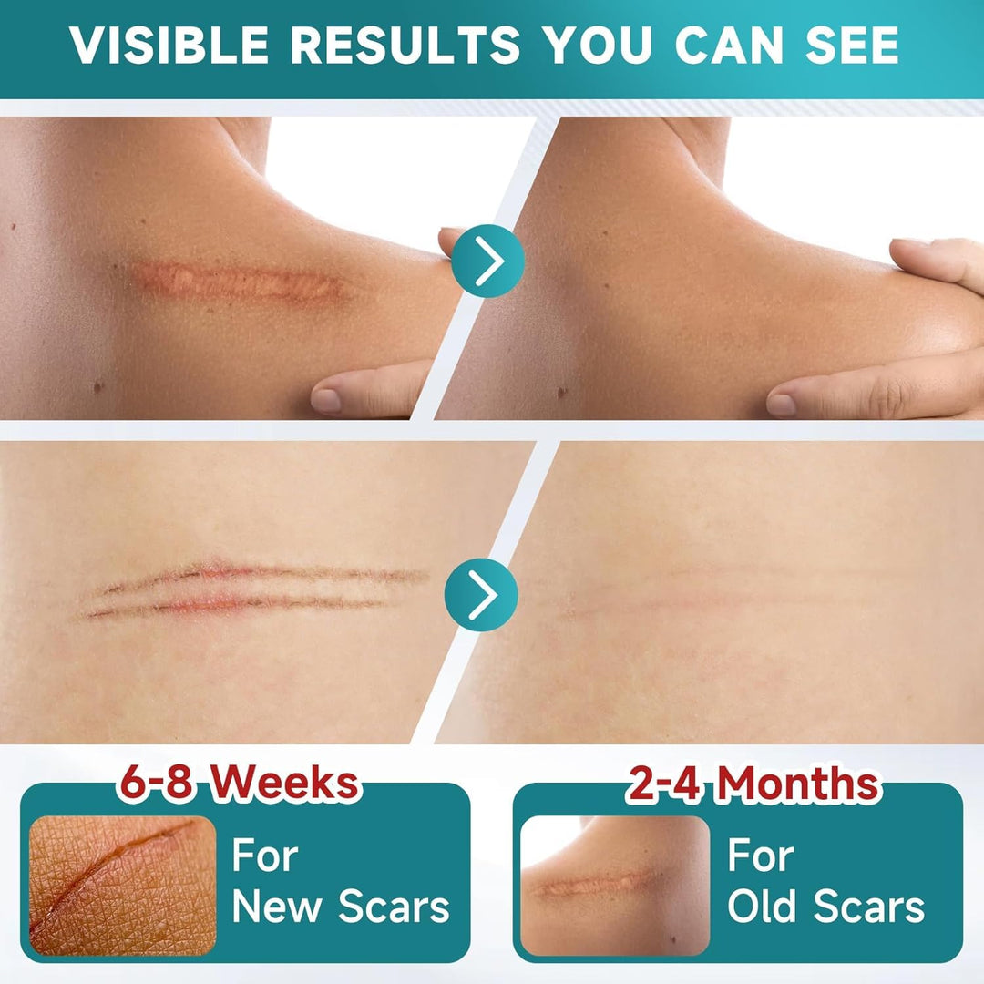 Silicone Scar Sheet (TR-204)