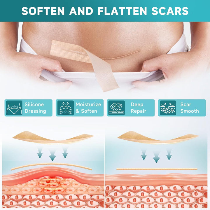 Silicone Scar Sheet (TR-204)