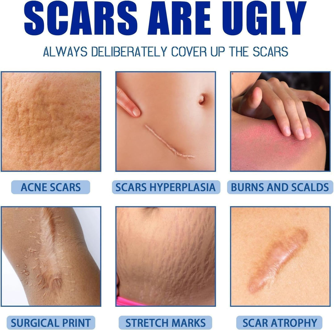 Scar Removal Gel (TR-165)