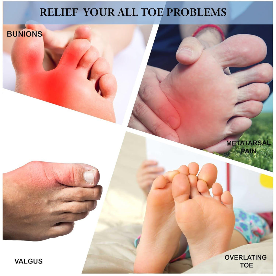 Silicone Toe Separator For Feet(TR-187)